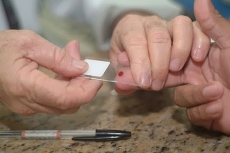 Como retirar vermes em um bassê