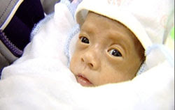 Hanoi doctors save 650g baby 640g baby born to 43y old mom