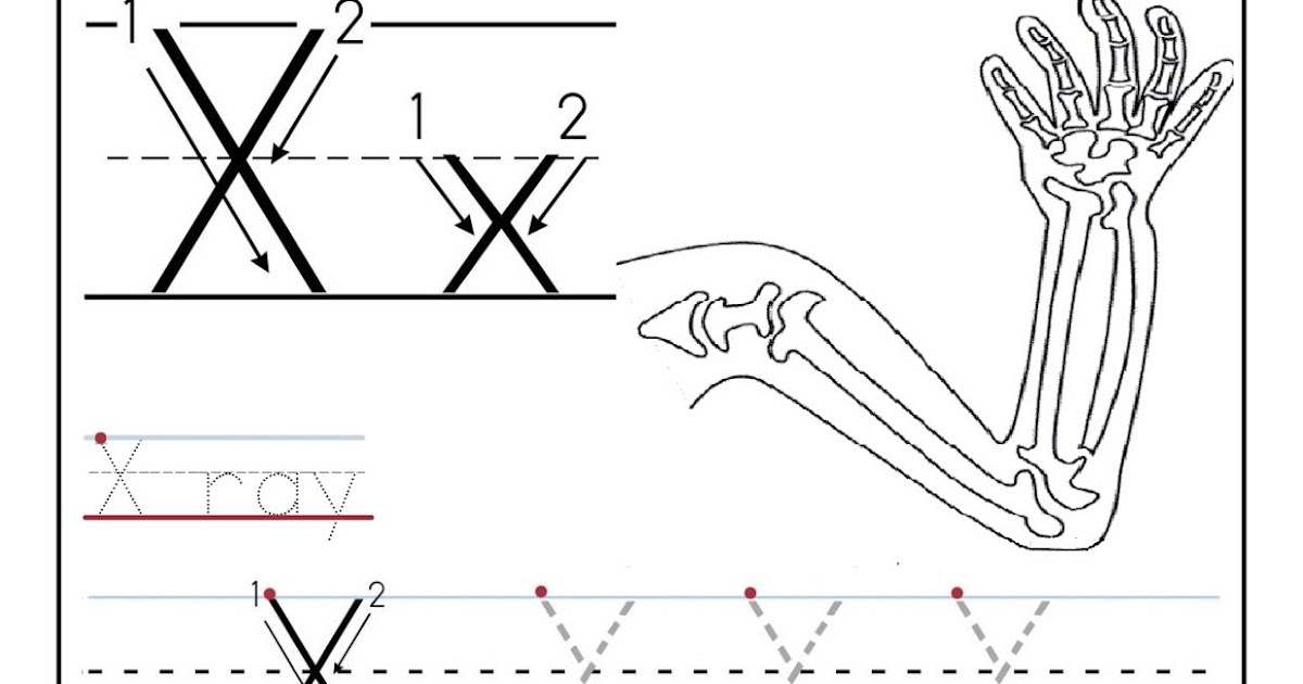 Free printable worksheet letter X for your child to learn and write