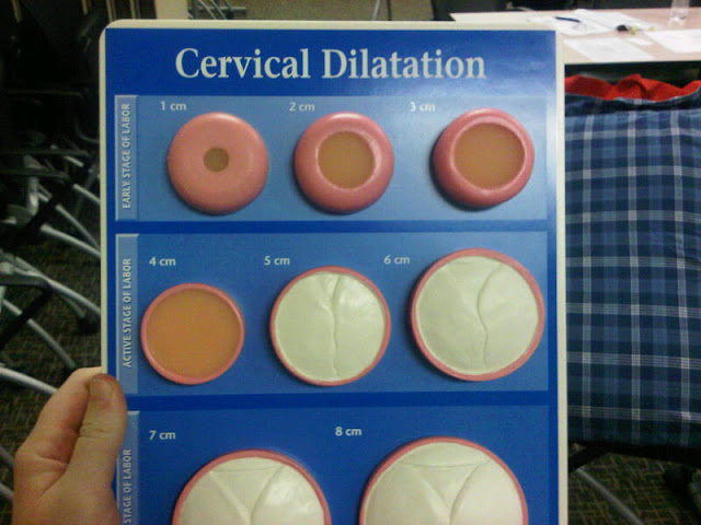 Dilation Chart