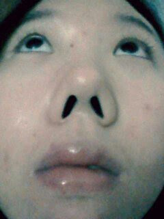 methods i ve tried to have a slimmer or smaller nose or whatever you