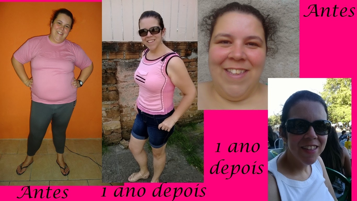 Diário da minha cirurgia bariátrica Um ano de bariátrica ANTES e DEPOIS