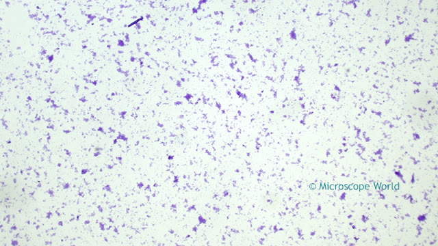 Clostridium Tetani under the microscope at 40x.