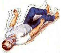 Image Result For Espasmo Muscular Image Result For Espasmo Muscular