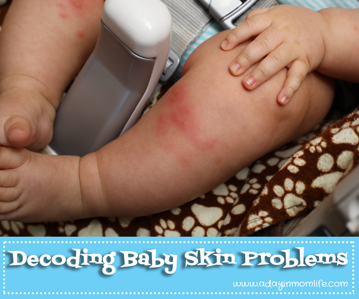 A Day in Mom Life Decoding Baby Skin Problems