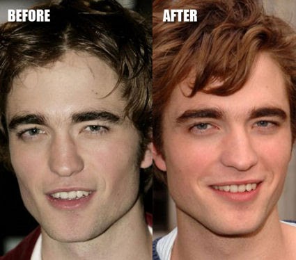 Plastic Surgery: Plastic Surgery Before and After The Difference