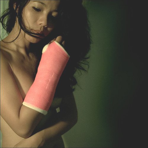 Casts & Lifestyle Artistic fiberglass cast