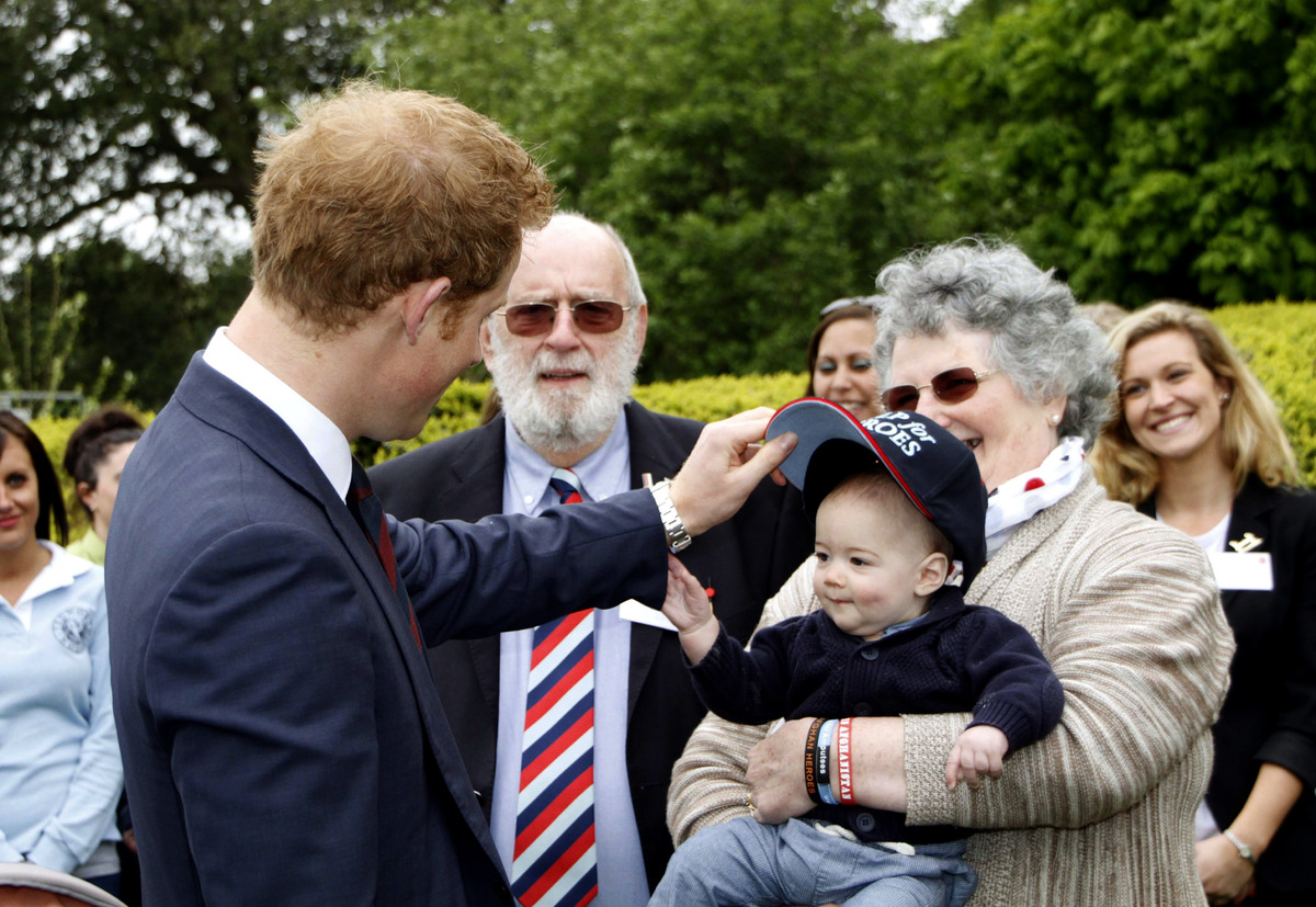 Prince Harry going bald?