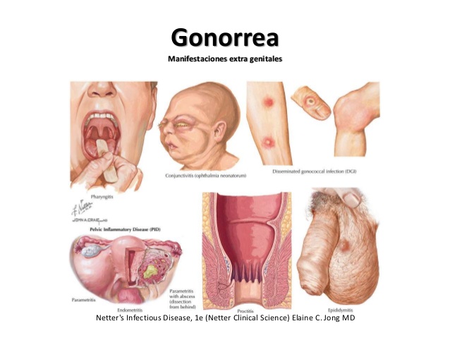 Como hacer así que la cutis era puro sin granos