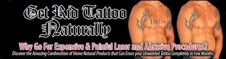 how much does it cost to remove a tattoo