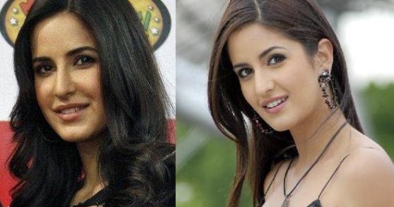 Katrina Kaif Plastic surgery disaster- Katrina before and after plastic