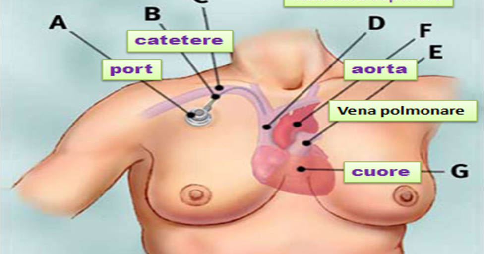 Varicosity trattamento fisso dalle risposte laser