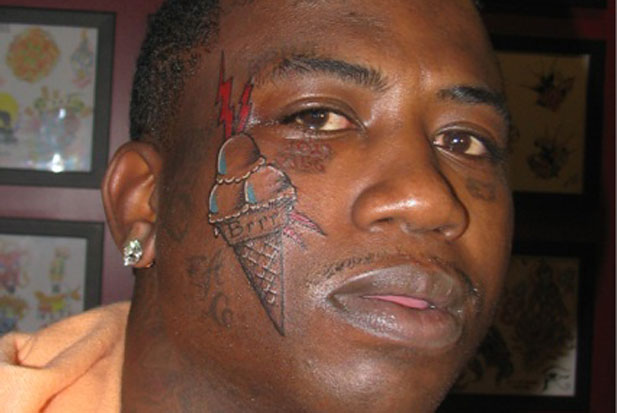 Removing Tattoos Removing Tattoos
