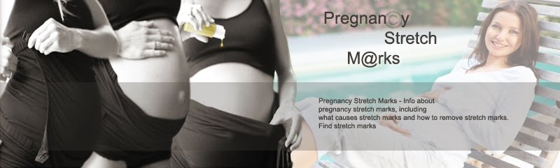 pregnancy stretch marks
