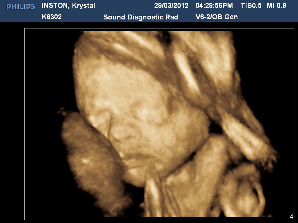 Sam and Krystal: 29 weeks - 3D ultrasound!