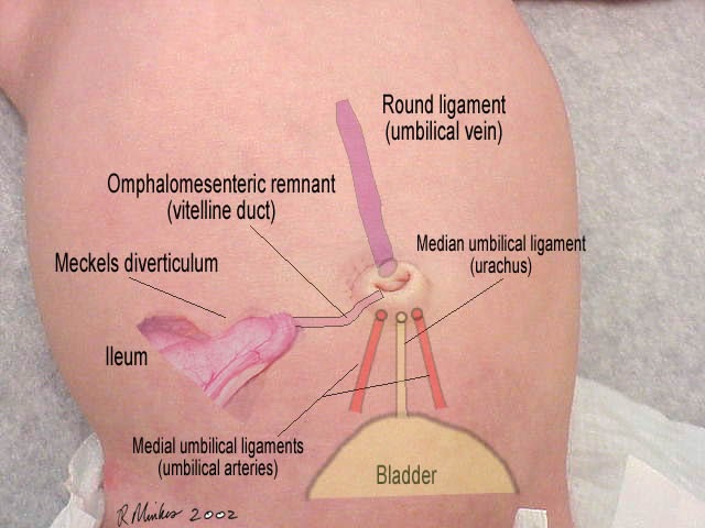 Umbilicus