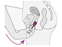 dentro da vagina o coletor menstrual se abrirá