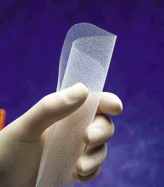 “What is mesh used in hernia surgery?” “What is mesh used in hernia surgery?”