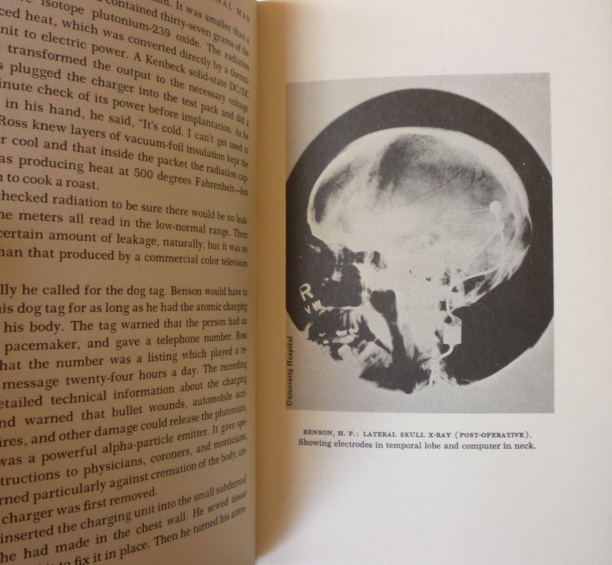 Terminal man michael crichton