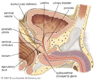 prostate cancer