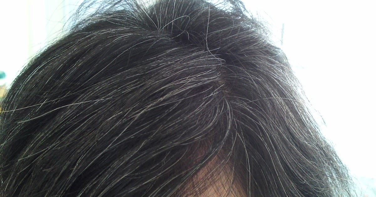 Wink And The World Surprises You Turning White Hair To Black