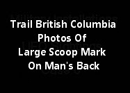 Trail British Columbia Photos Of Large Scoop Mark On Man's Back