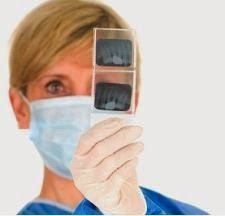 Dental Implants Maryland