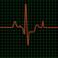 frisbee pulse