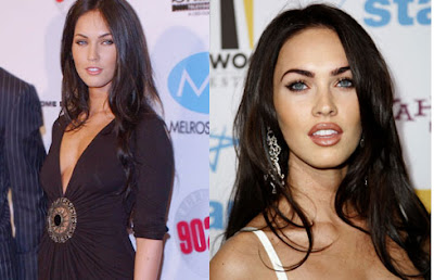 Megan Fox plastic surgery