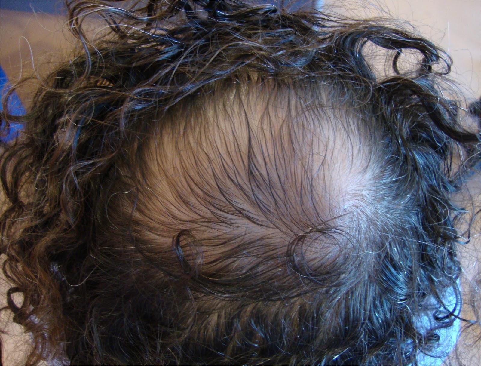 La máscara con aloya para el crecimiento de los cabello