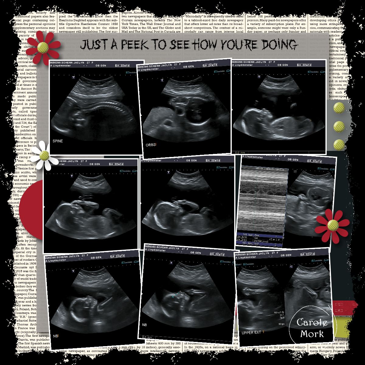 Carole's Corner of Crafts MDS 095 Ultrasound Scrapbook Page