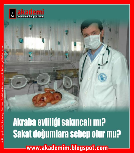 Akraba evliliği sakıncalı mı? Sakat doğumlara sebep olur mu?