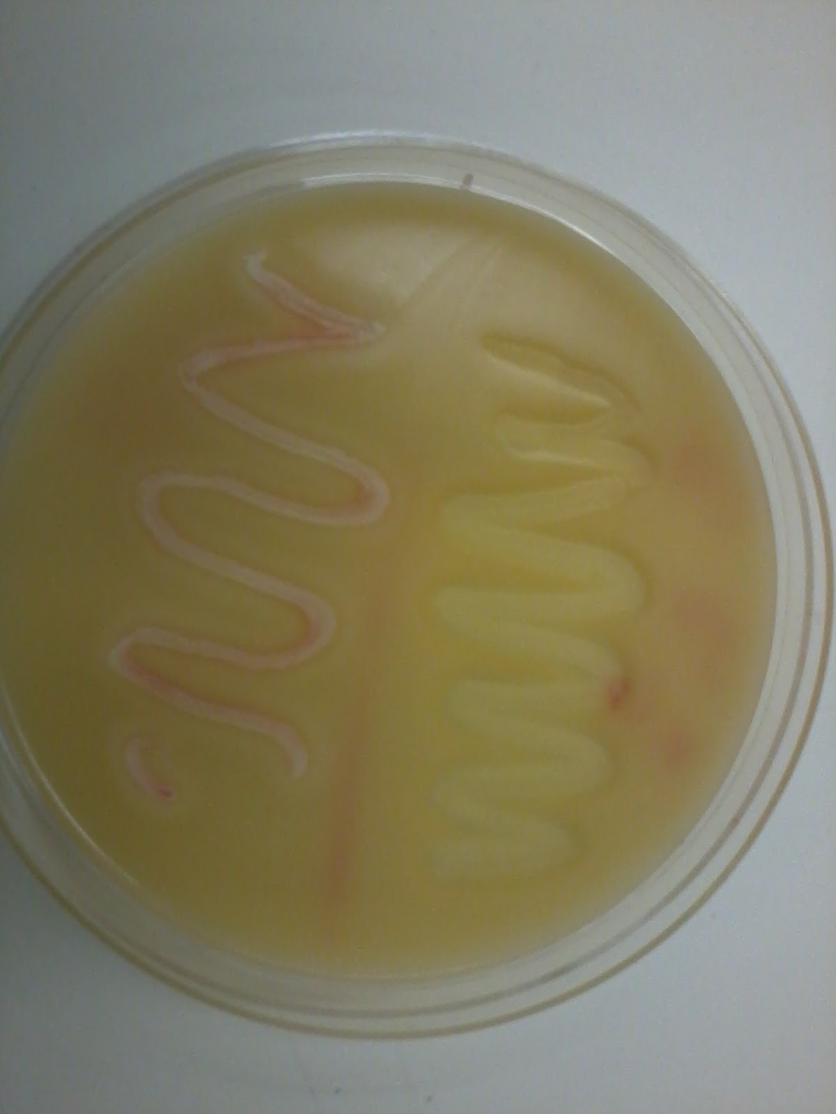 Gram negative bacteria in gelatin hydrolysis test emleo