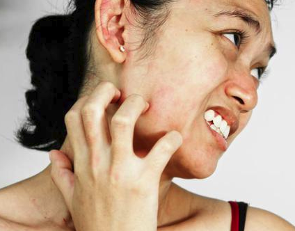 Tips Menghilangkan Panu Kudis Kurap Hanya Dalam 1 Hari Kesehatan