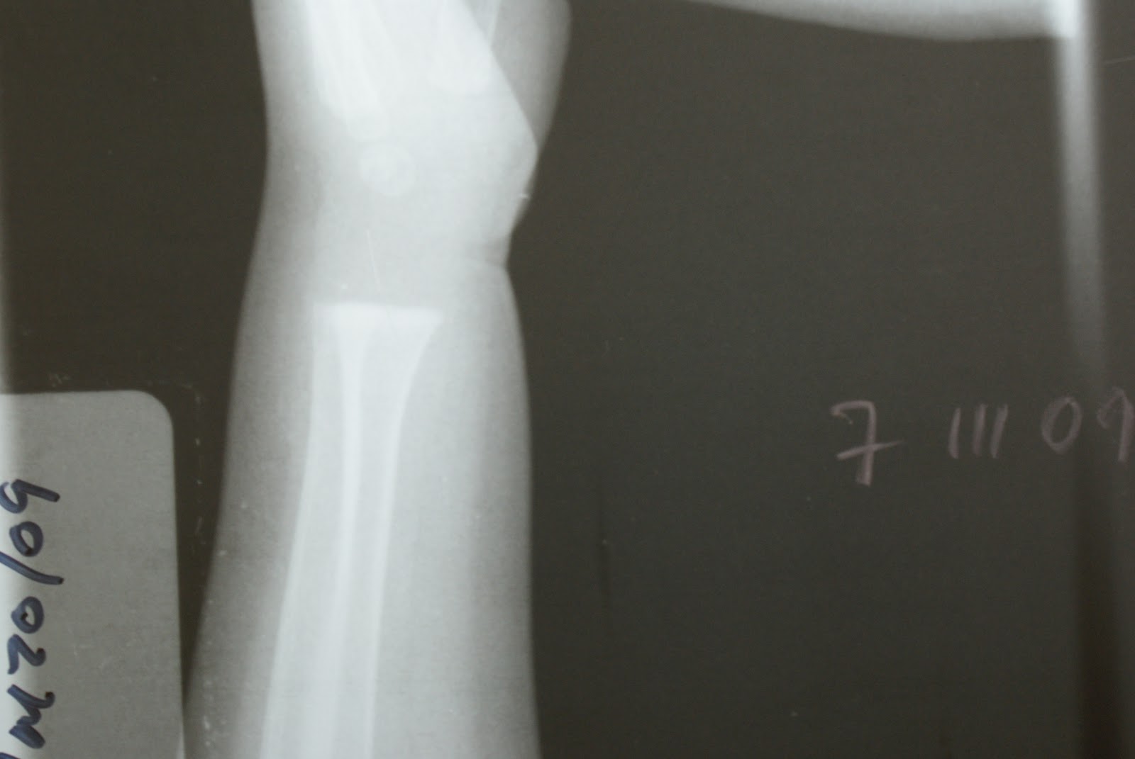 Ossa Carpalia C Octubre 11