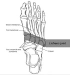 Where is my Lisfranc ?