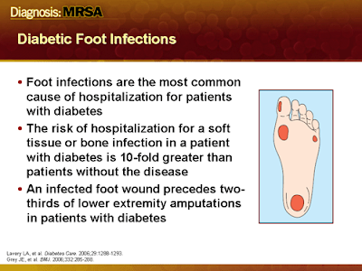 Treating a diabetic foot ulcer 1984