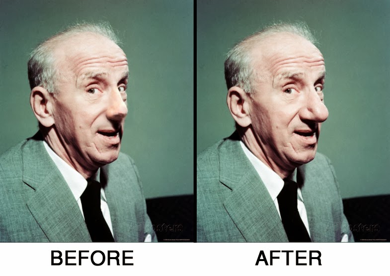 jimmy-durante+before+AND+AFTER.jpg
