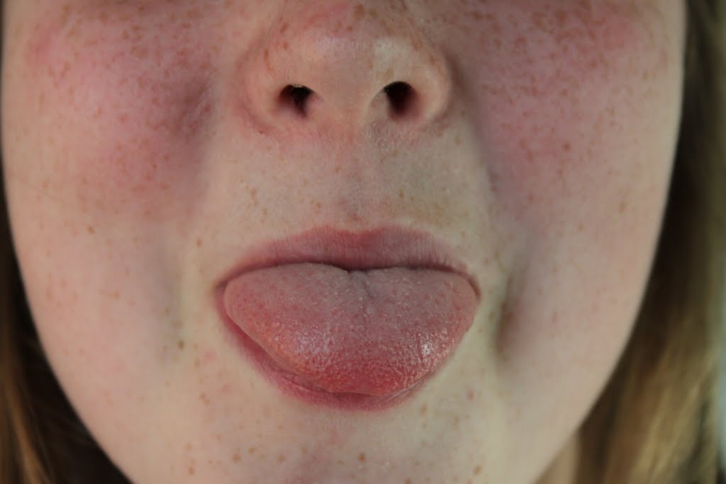 Regimsansel steek je tong uit tegen kanker