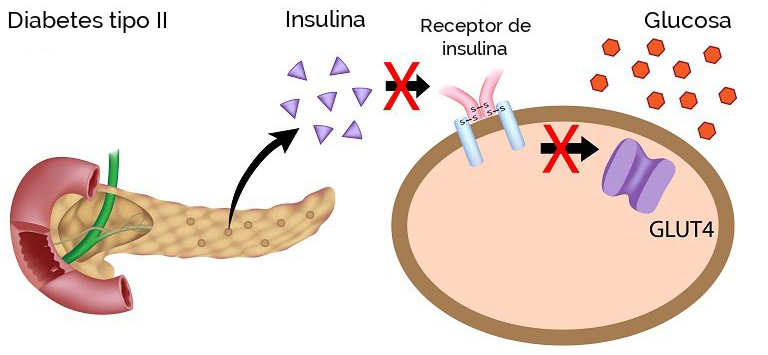 Todo sobre la diabetes: ¿QUÉ ES LA DIABETES? Todo sobre la diabetes: ¿QUÉ ES LA DIABETES?