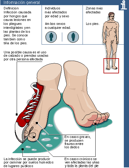 Oksolinovaya el ungüento para el tratamiento de las uñas