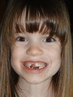 RHODES FAMILY: Toothless