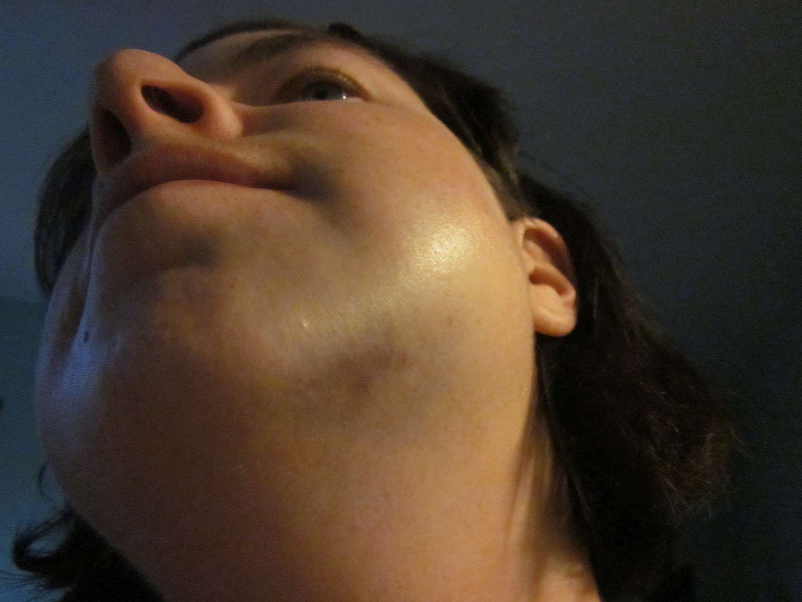 Life Happens Wisdom teeth and scary pictures!!