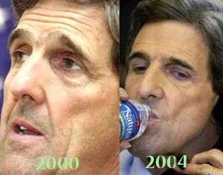 John Kerry Plastic Surgery Before and After John Kerry Plastic Surgery Before and After
