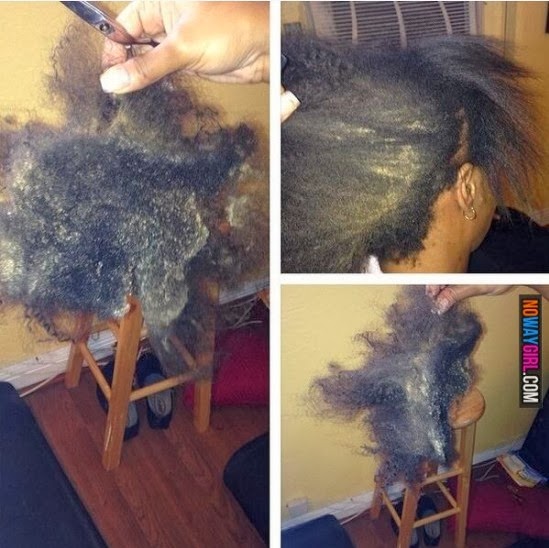 How Disgusting? Her Hair Grew Mold Because She Left A Weave In For Too Long