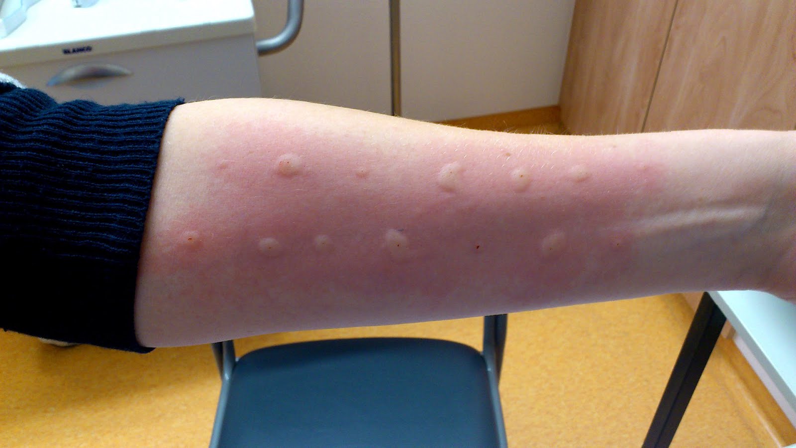 How Do You Know If You Re Allergic To Cats Cat Choices