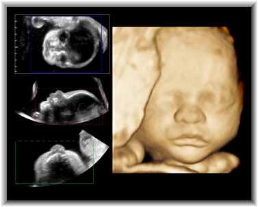 Images Of Ultrasounds