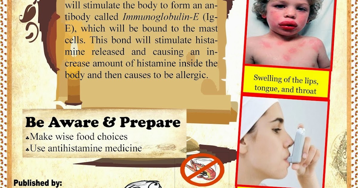 Food, Body & Soul SHRIMP ALLERGY