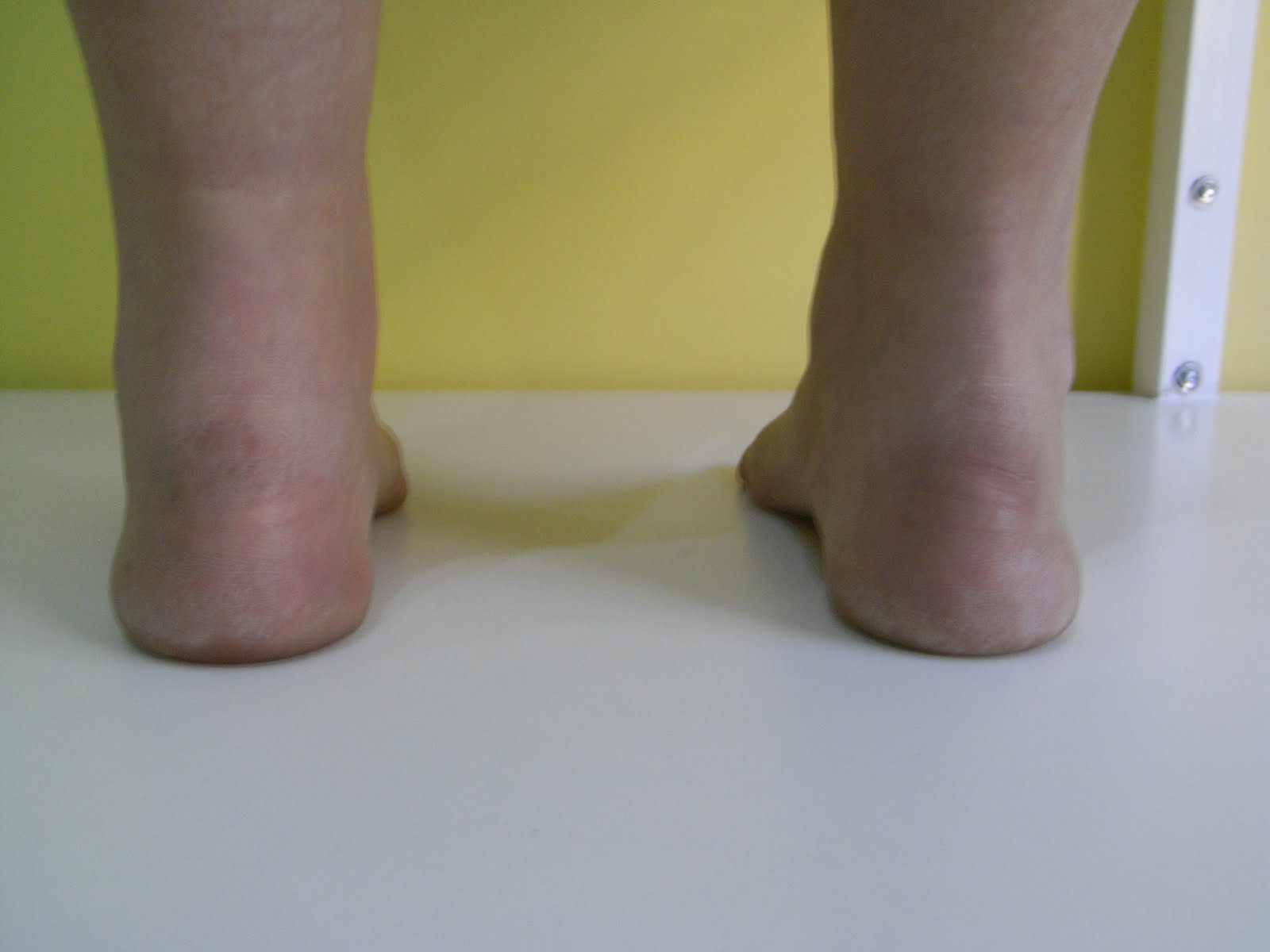 Ortopodologia y Biomecanica FOOT POSTURE INDEX