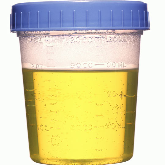 Image result for urine